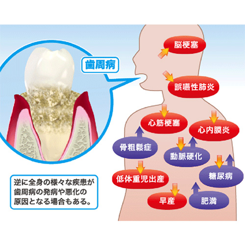 全身疾患との関係