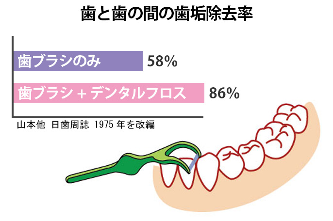 歯石除去率